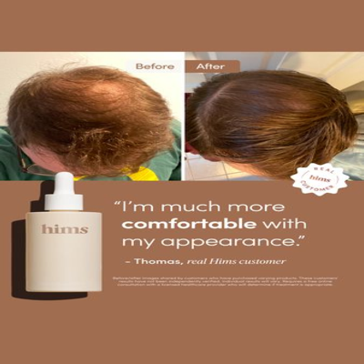 as seen in social proof ad template — Hims