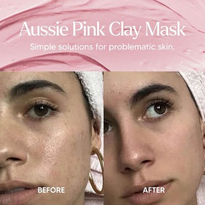 versus comparison ad template — Alya Skin Australia