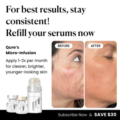 differentiation comparison ad template — Qure