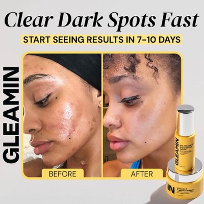 alternative comparison ad template — Gleamin