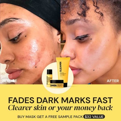 competitor comparison ad template — Gleamin