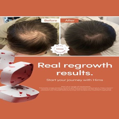 differentiation comparison ad template — Hims