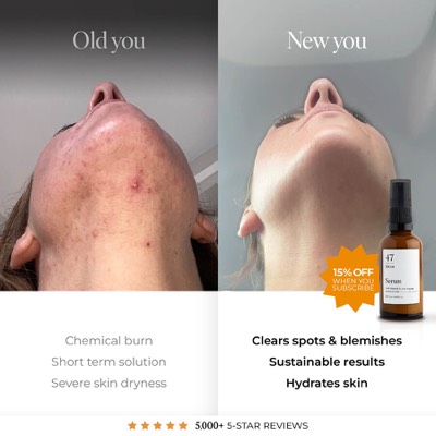 competitor comparison ad template — 47 Skin